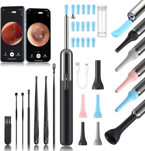 3-in-1 HD Ear Wax Removal Kit with Camera