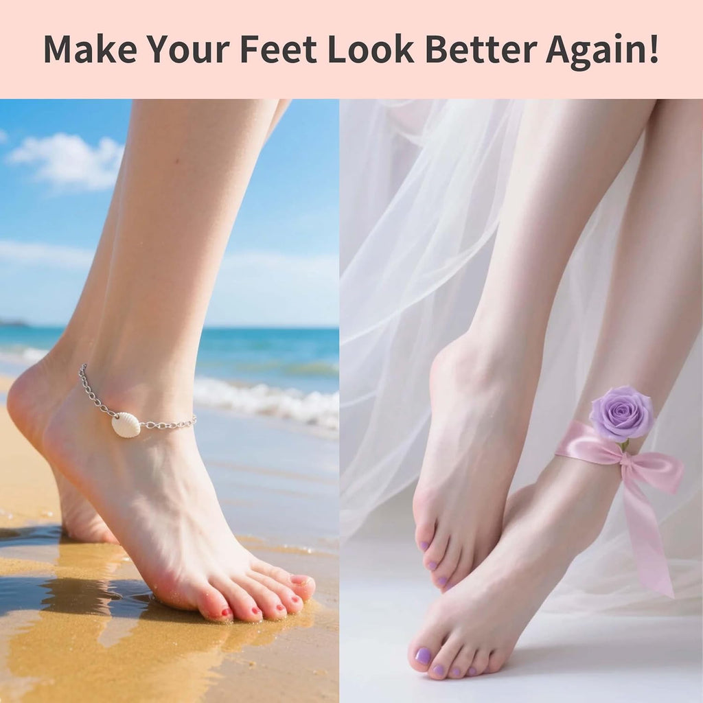 Electric Foot Callus Remover – Rose Pink
