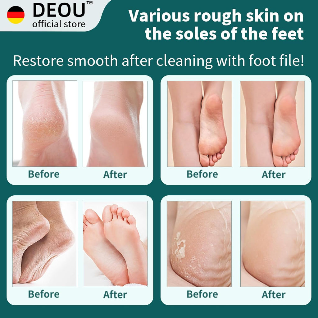 Metal Foot File for Callus & Dead Skin