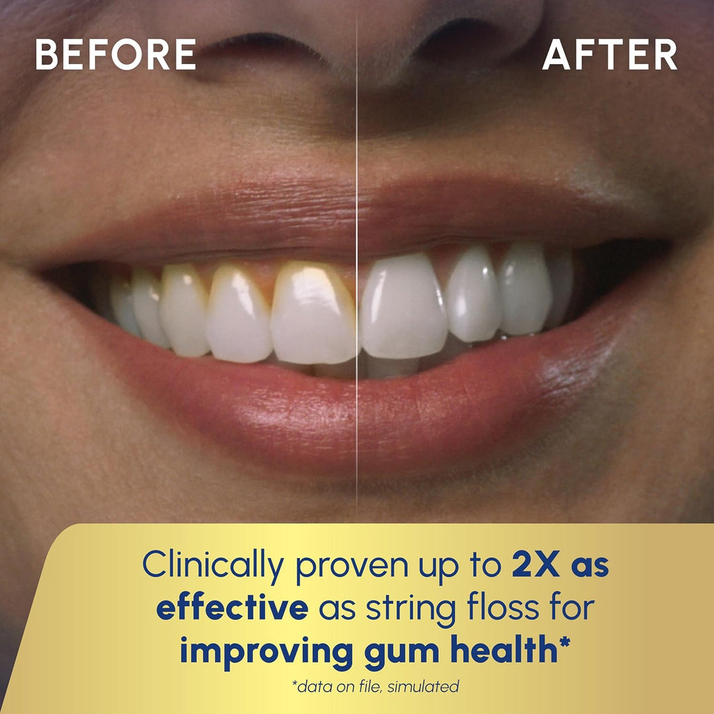 Aquarius Water Flosser for Teeth & Gum Care