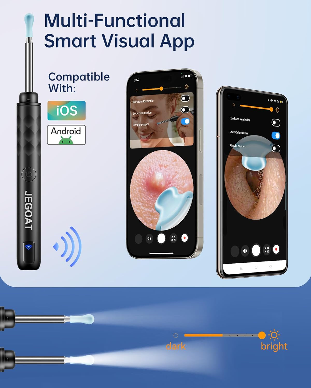 HD Ear Wax Removal Kit with Camera & LED