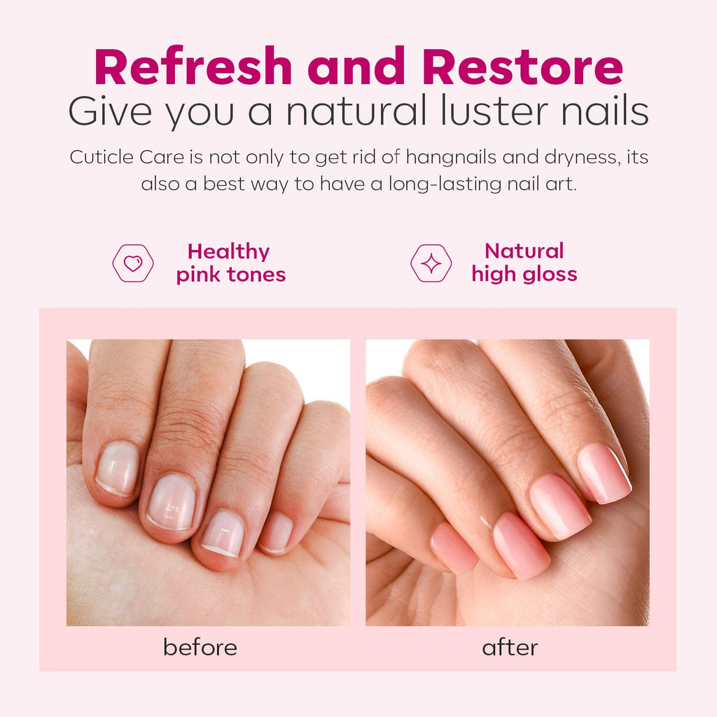 Cuticle Remover & Nail Care Kit