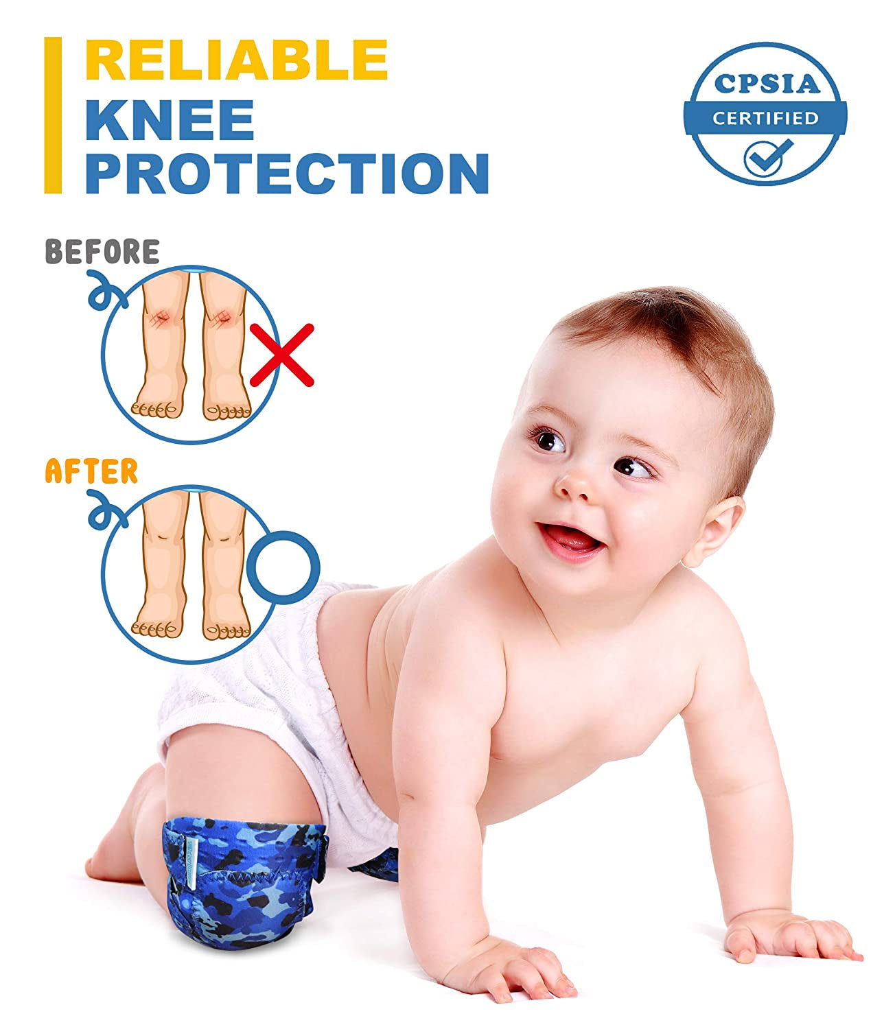 Baby Crawling Knee Pads (2 Pairs), Rodilleras Para Bebe - Comfortable Knee Protector for Toddler, Infant, Girl, Boy, Crawler