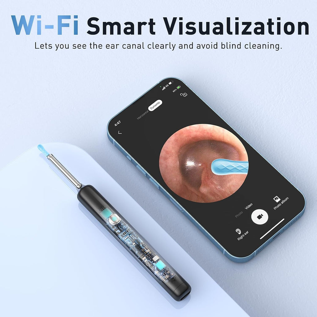 Electric Ear Wax Removal Kit with Camera