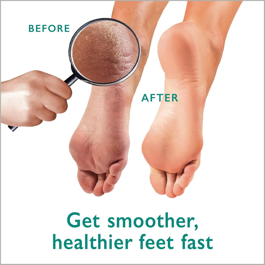 Callus Remover Gel & Foot Scrubber Kit