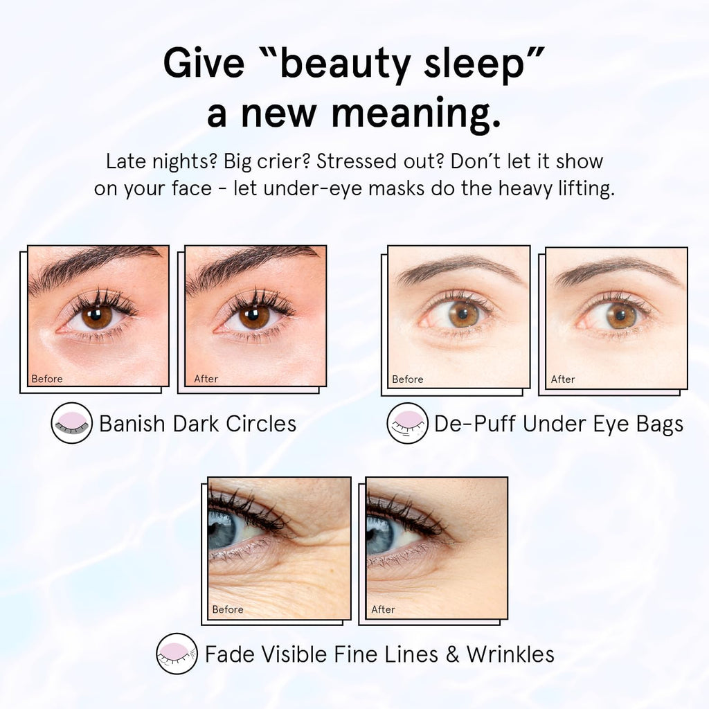 Retinol Eye Patches for Dark Circles & Puffiness