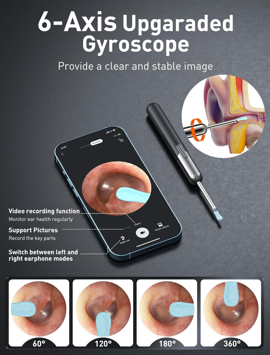 3-in-1 HD Ear Wax Removal Kit with Camera