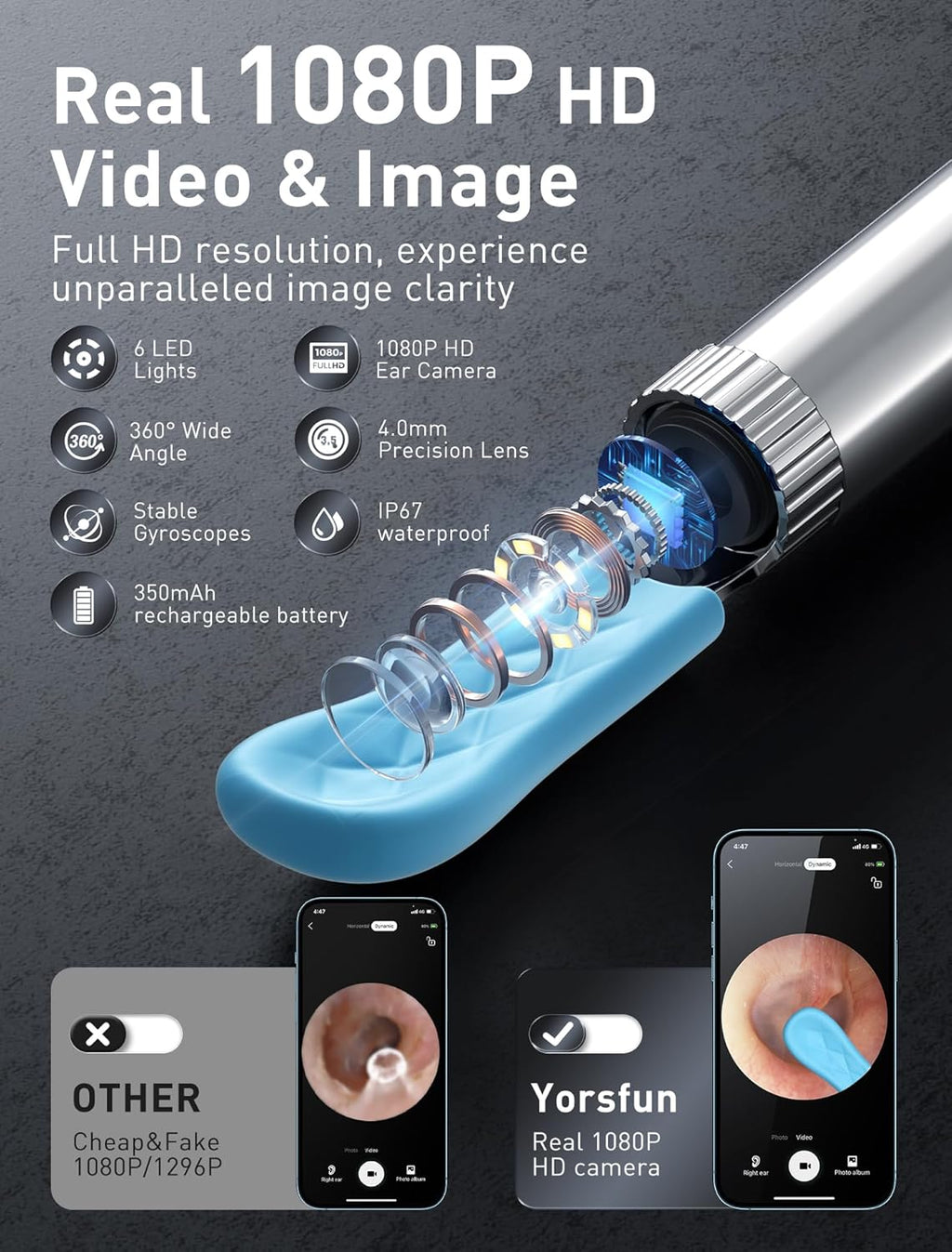 3-in-1 HD Ear Wax Removal Kit with Camera