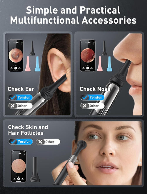 3-in-1 HD Ear Wax Removal Kit with Camera